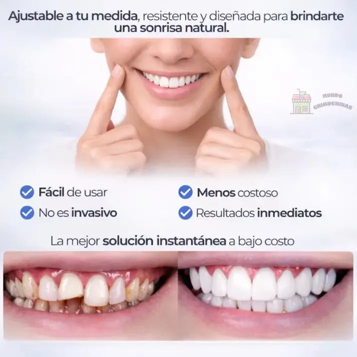 SmileSnap - Sonrisa impecable en segundos