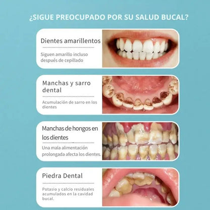 Limpiador Dental Eléctrico - Sonrisa más limpia y fresca cada día
