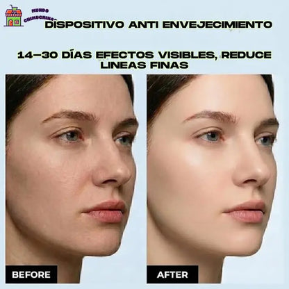 Pack Masajeador Cuello y Cara Antiedad Led + Serum Vitamina C