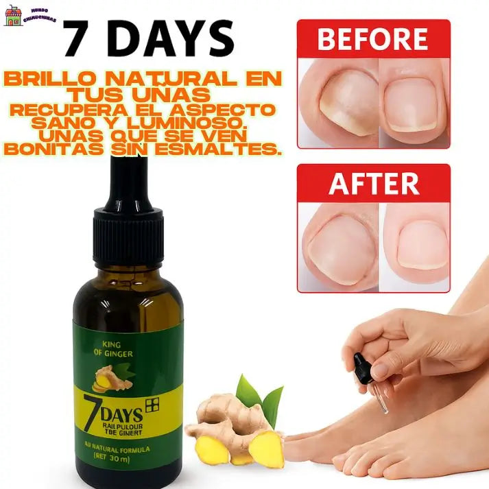 GingerVital - Nutrición profunda para uñas sanas y resistentes