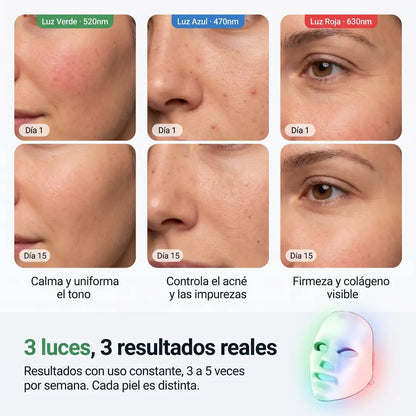 Halo Skin - Menos rojeces, sin maquillaje